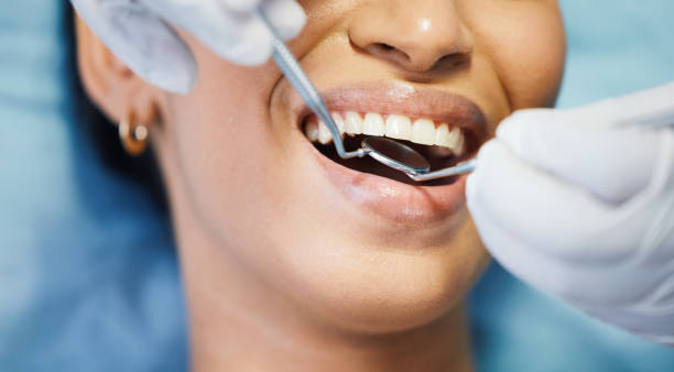Best Emergency Dentist for Special Needs Patients in Monroe, GA