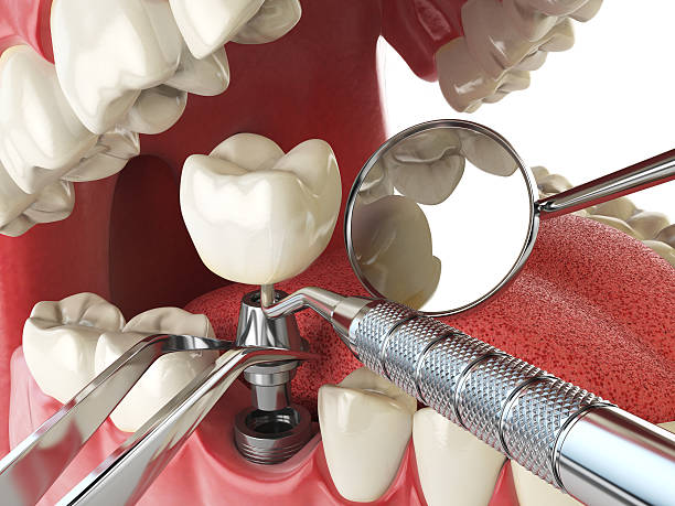 Best Mobile Emergency Dentist in Monroe, GA